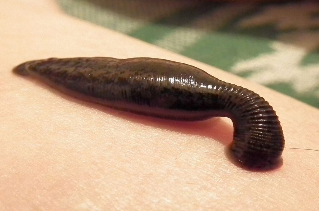 Leech Collectors: Suppliers for Medical Bloodletting