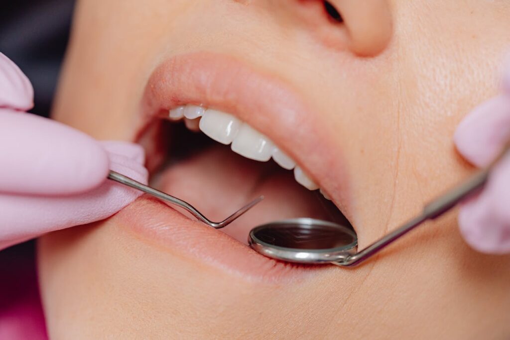 Dreaming of Tooth Loss
