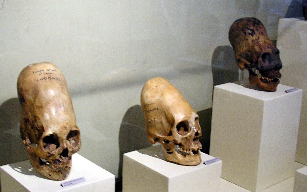 Perplexing Paracas Skulls