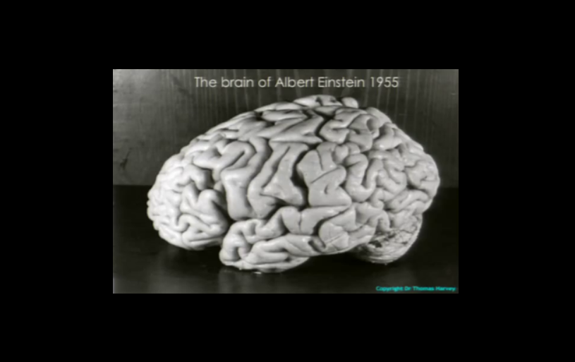 Albert Einstein's Brain