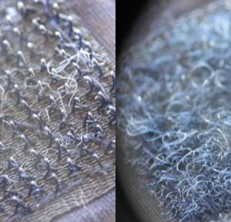 Velcro: From Space Tech to Everyday Use